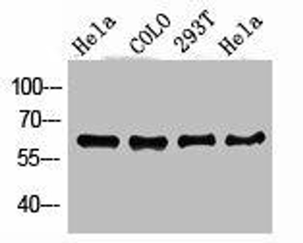 PDPK1 Antibody (PACO06741)