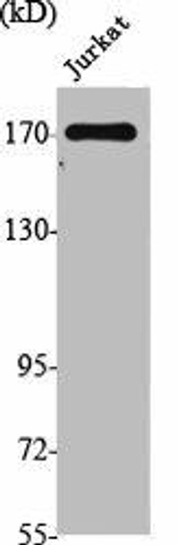 TOP2A Antibody (PACO06837)