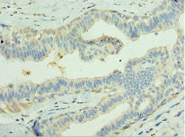 LGI1 Antibody (PACO43882)