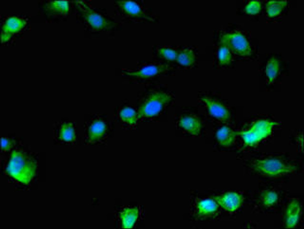 RAB1B Antibody (PACO49294)