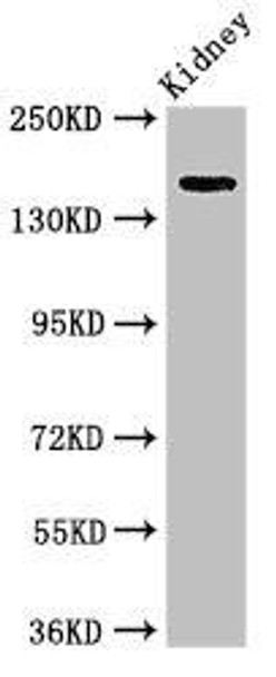 USP6 Antibody (PACO50090)