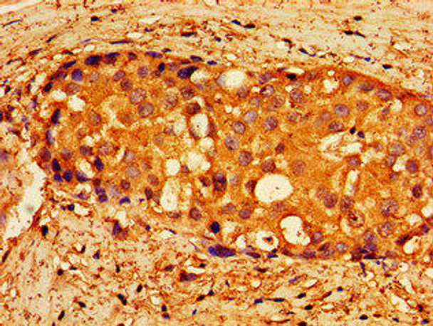 NPTX1 Antibody (PACO55102)