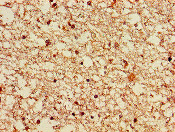 LRRK2 Antibody (PACO55170)