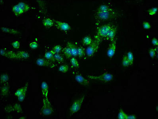 NEK4 Antibody (PACO56896)