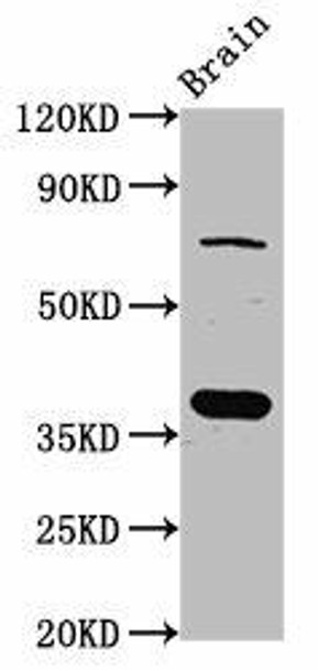 SCAMP1 Antibody (PACO56968)