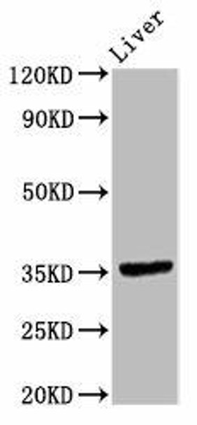 EPCAM Antibody (PACO57024)