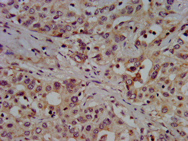 SLC7A1 Antibody (PACO57980)