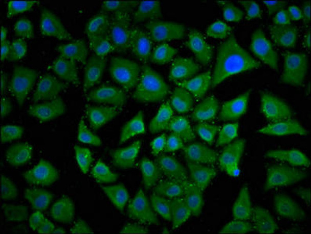 MKL1 Antibody (PACO62587)