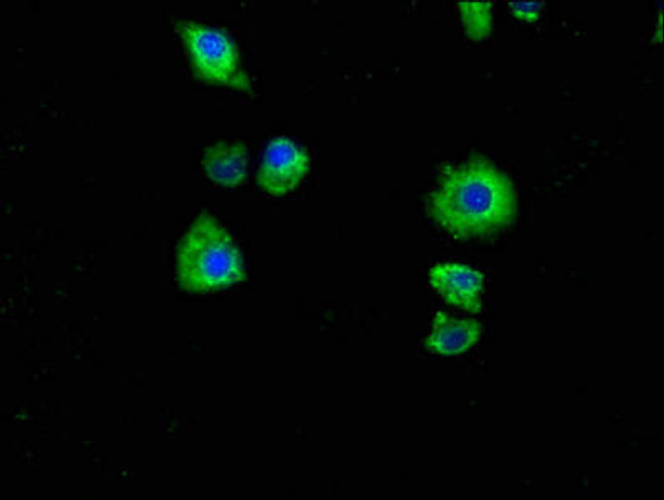 P2RX7 Antibody (PACO62807)