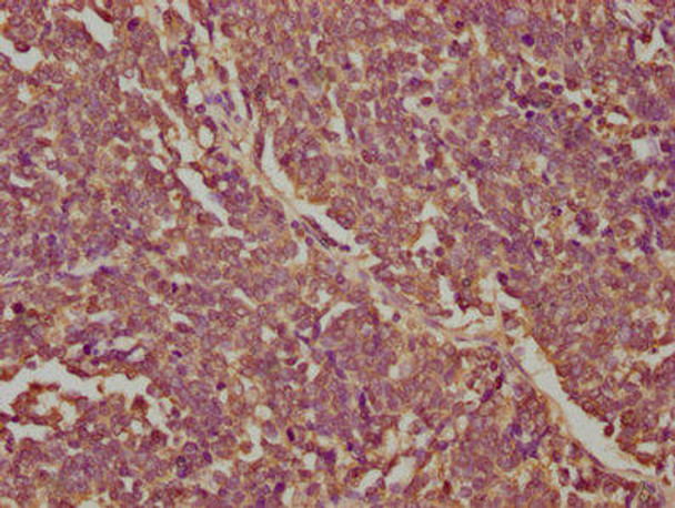 ORM1 Antibody (PACO62955)