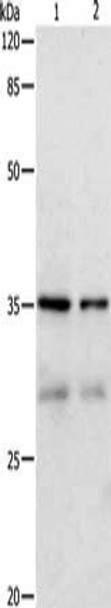 CDK4 Antibody (PACO14221)