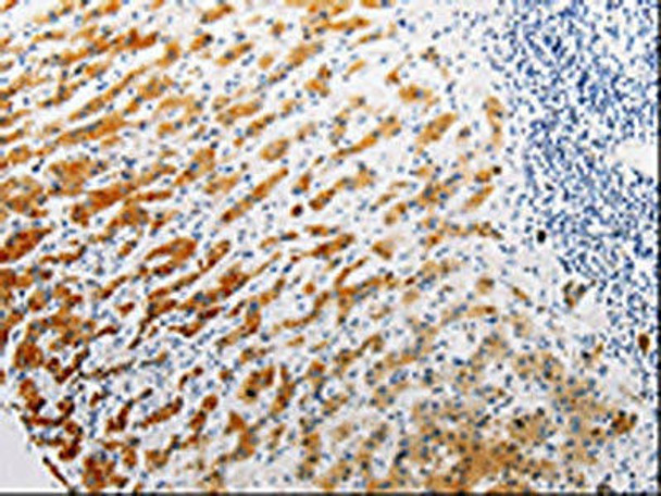 CLEC1B Antibody (PACO14256)