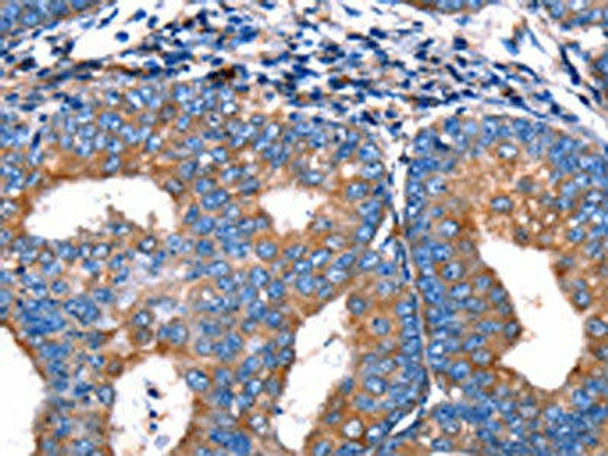 MERTK Antibody (PACO14264)