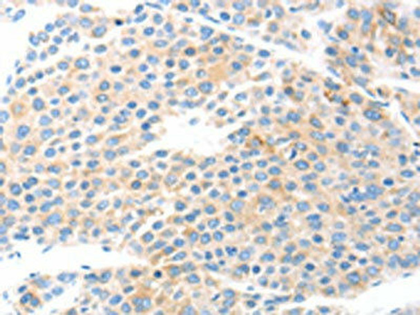 COL2A1 Antibody (PACO14271)