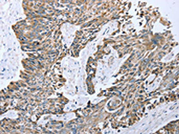 CPT1A Antibody (PACO14285)