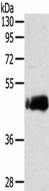 SDCCAG3 Antibody (PACO14325)
