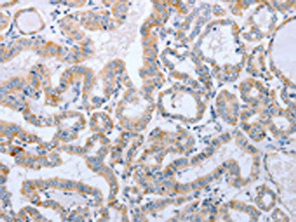 DNMT3L Antibody (PACO14346)