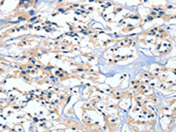 EDN3 Antibody (PACO14402)