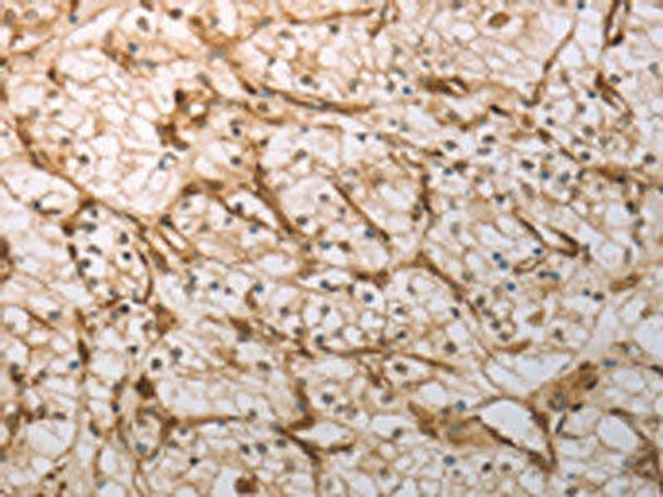 INHA Antibody (PACO14581)