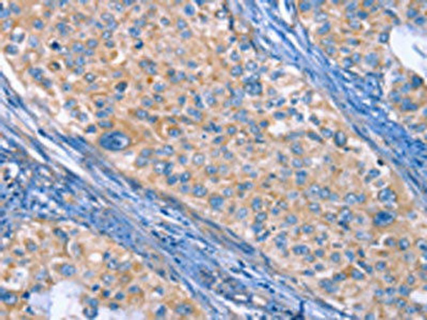 ITGB3 Antibody (PACO14585)