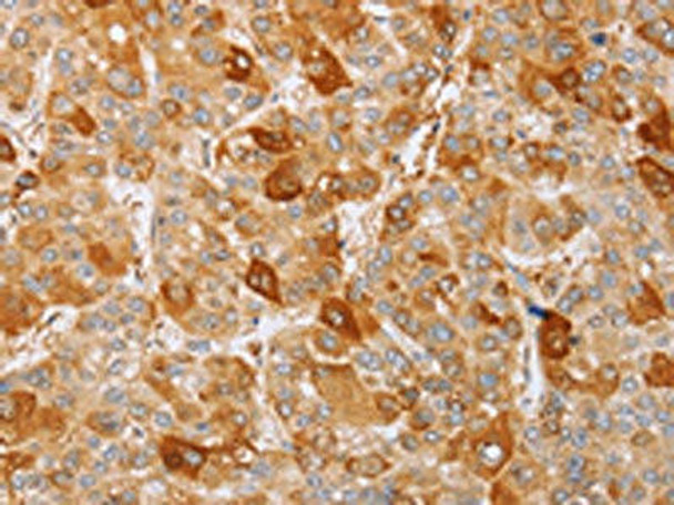 MCM5 Antibody (PACO14687)
