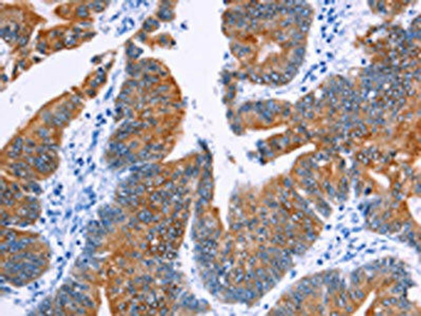 NR4A2 Antibody (PACO14790)