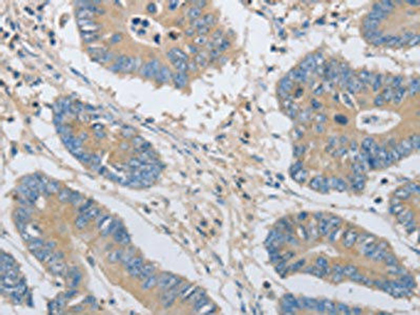 OASL Antibody (PACO14794)