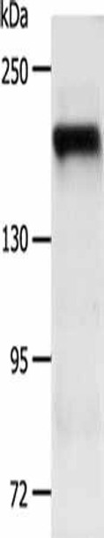 PDGFRB Antibody (PACO14862)
