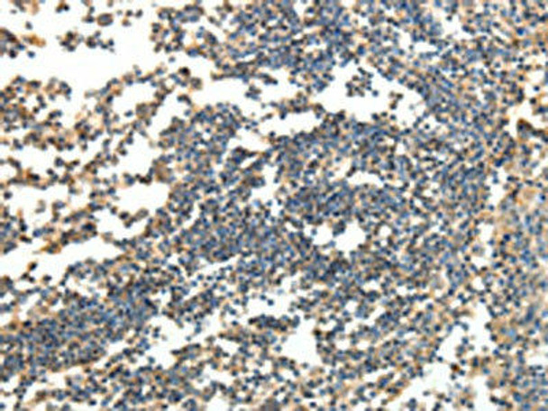 SPAG8 Antibody (PACO15027)