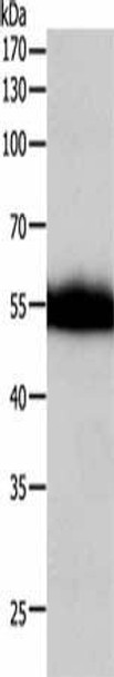 F10 Antibody (PACO15096)