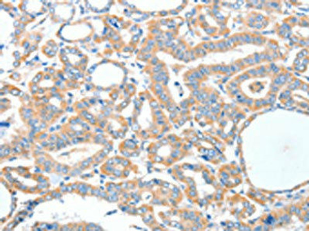 ADCK1 Antibody (PACO15319)