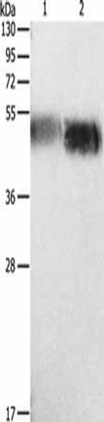 ORM1 Antibody (PACO15393)