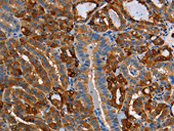 CRYAB Antibody (PACO15403)