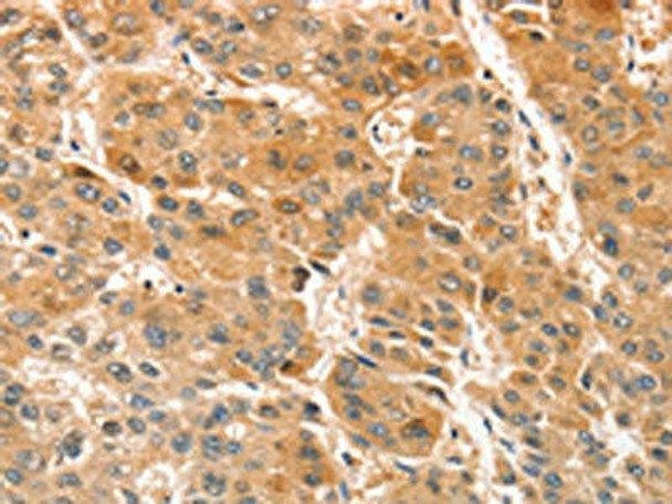 APTX Antibody (PACO15489)
