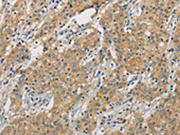 ARHGEF7 Antibody (PACO15516)