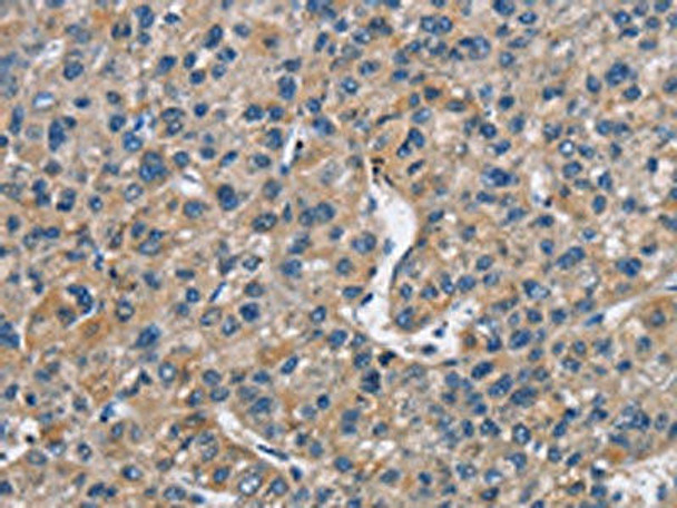 FLT3 Antibody (PACO15540)