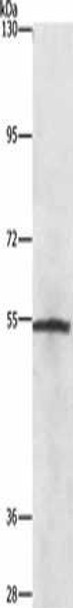 NEK2 Antibody (PACO15695)