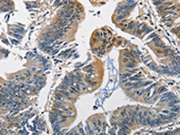 PGK1 Antibody (PACO15756)