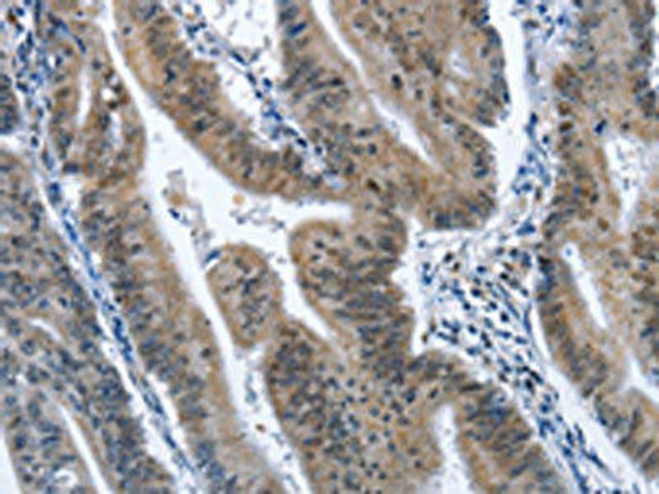 CADM3 Antibody (PACO15903)