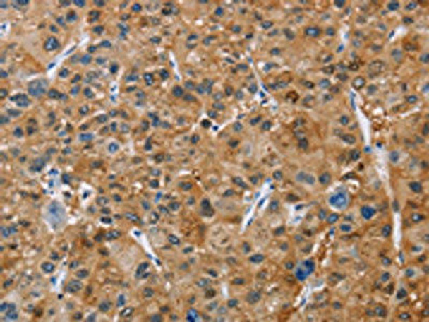 NCR3 Antibody (PACO15982)