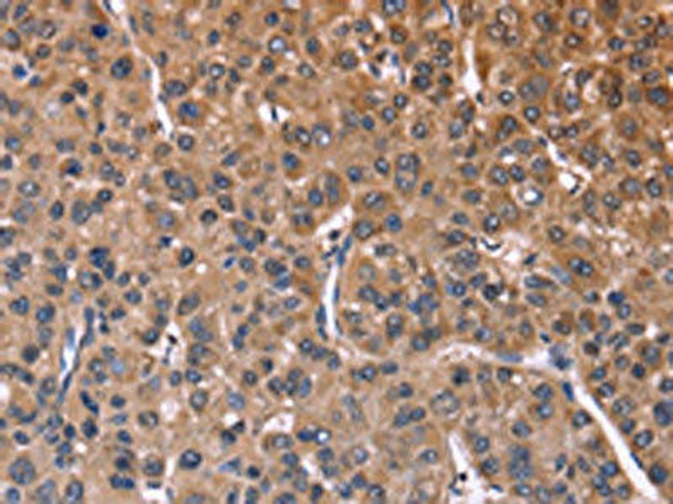 SEPT7 Antibody (PACO15990)