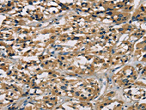 CGA Antibody (PACO16018)