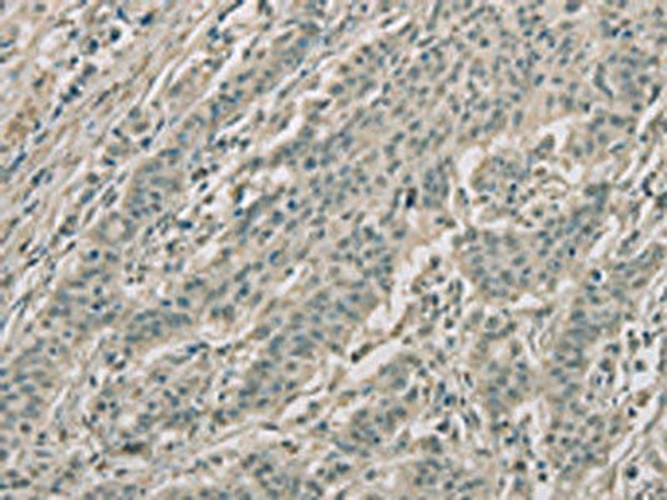 RNASE3 Antibody (PACO16224)