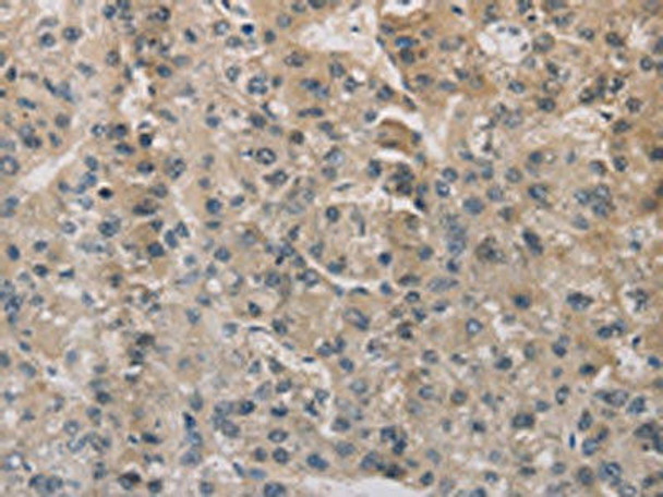 ESRRG Antibody (PACO16270)