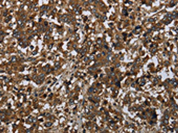 HOMER2 Antibody (PACO16475)