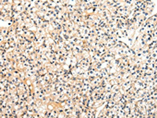 VASH1 Antibody (PACO17412)