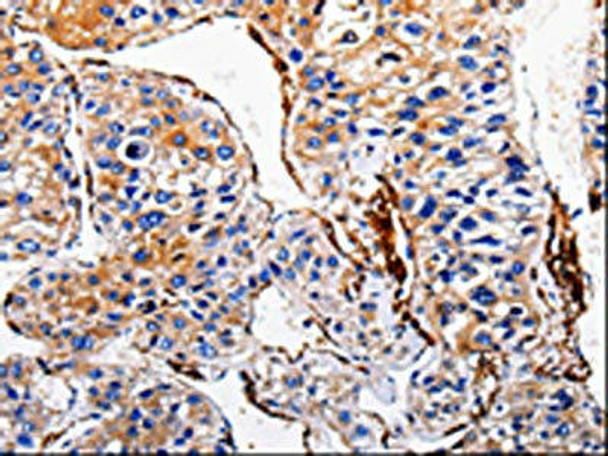 ACE2 Antibody (PACO17482)