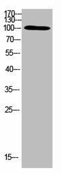 TRPV4 Antibody (PACO07462)