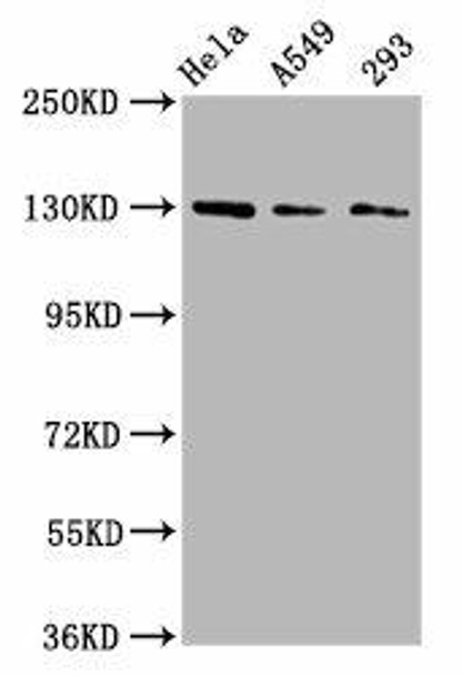 SEMA6D Antibody (PACO59313)