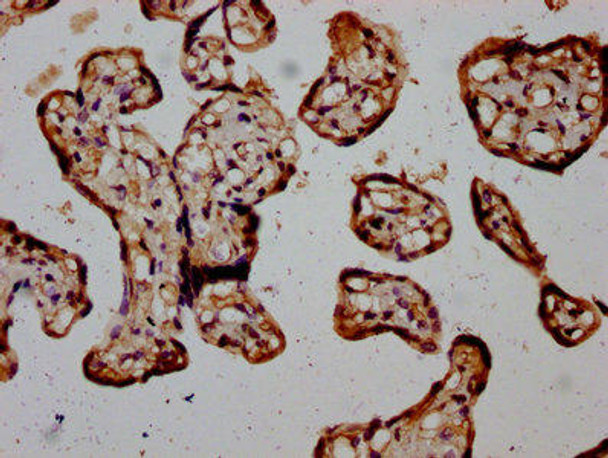 RIOK2 Antibody (PACO60408)